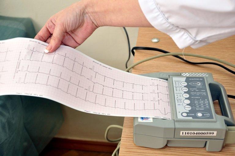 Телемедицинский комплекс автоматизированной оценки ЭКГ может появится в больницах Иркутской области