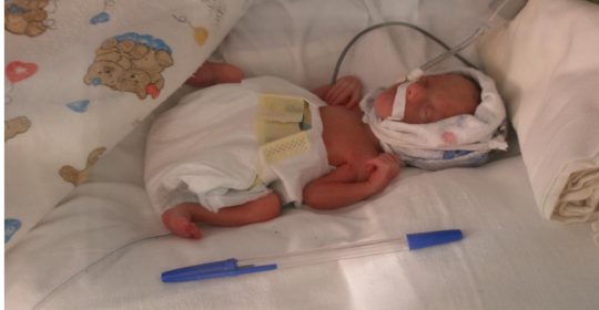 Врачи в Бурятии выходили 500-граммового новорожденного