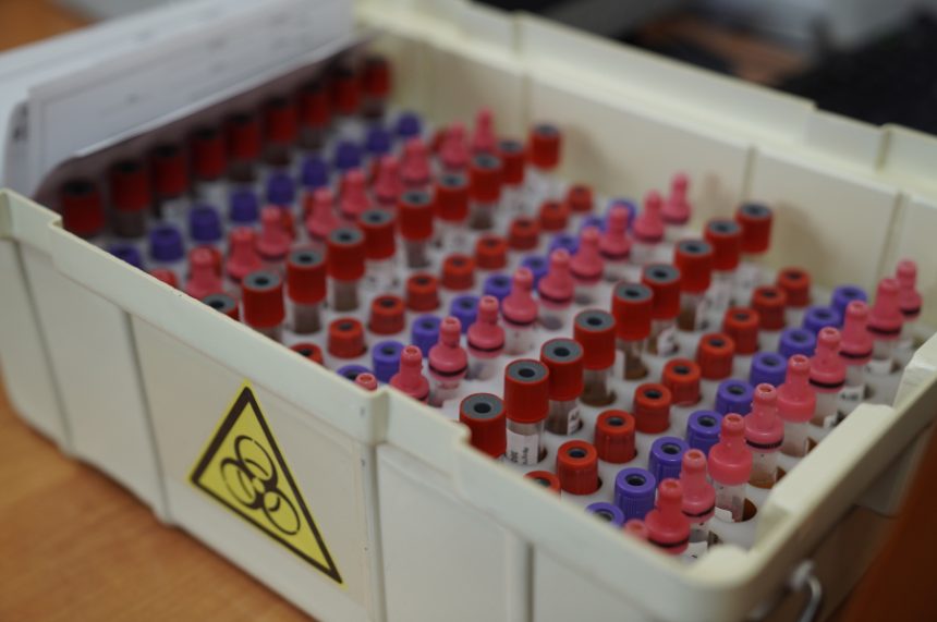 Во время донорской акции #МыВместе в Приангарье заготовили 198 литров донорской крови