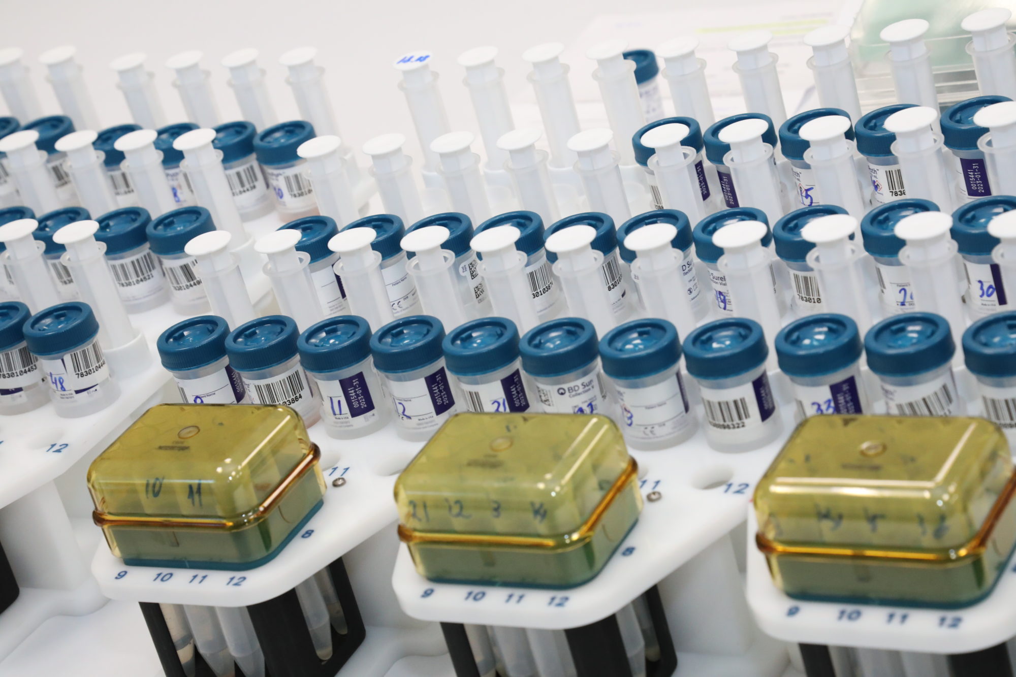 Число случаев заболевания коронавирусом в Приангарье превысило 17 тысяч