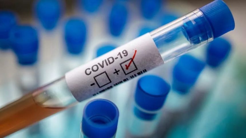 275 новых случаев заболевания COVID выявили в Иркутской области за сутки