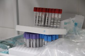 262 случая COVID подтвердили в Иркутской области за сутки
