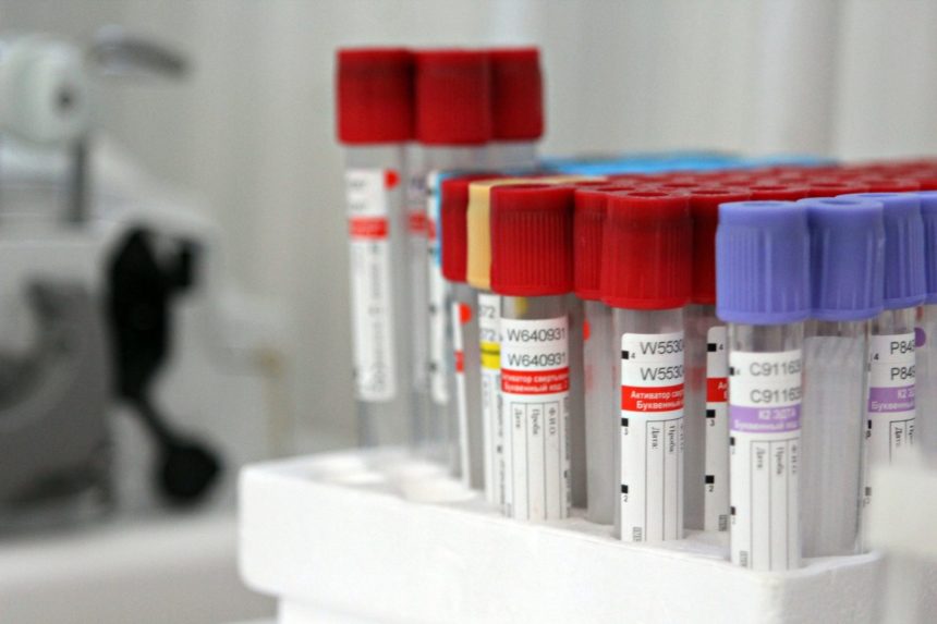 Почти тысячу случаев коронавируса выявили в Иркутской области за неделю