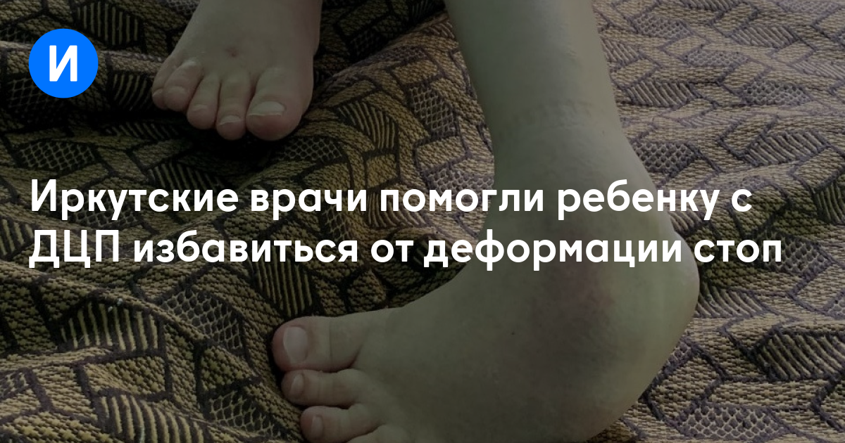 Иркутские врачи помогли ребенку с ДЦП избавиться от деформации стоп